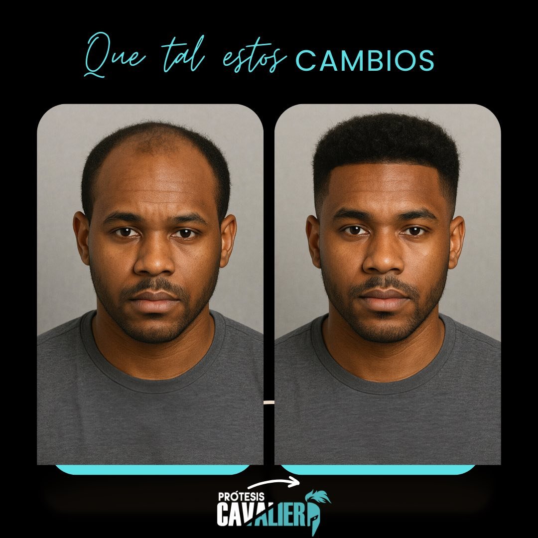 cavalier5